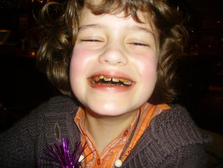 Wendy fait dents pouries!